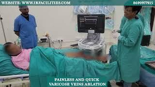 Painless and Quick Varicose Veins Ablation by Dr. Sandeep Sharma | IRFACILITIES