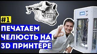 Мамедыч - жизнь нейрохирурга. Начало. Печатаем челюсть на 3d принтере