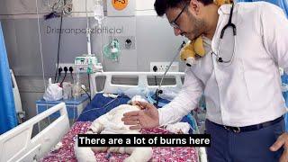 Severe Burn In Children Please Take Precautions And Avoid Such Horrible Accidents | Dr Imran Patel