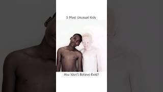 5 Most Unusual Kids You Won't Believe Exist!