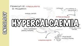 Hypercalcemia in malignancy - causes, pathophysiology, symptoms, treatment