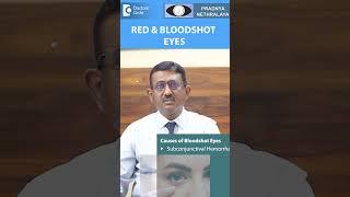 Red Eyes & Bloodshot Eyes |Causes of Red Eye & Diagnosis-Dr.Sriram Ramalingam|Doctors' Circle#shorts