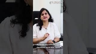 How long does it take for acne scars to heal? | Dr. Divya Sharma