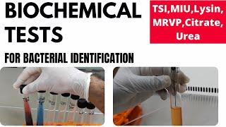 Biochemical Tests for Bacterial Identification (Part-1)_TSI, MIU, MR-VP, Lysin, Urea, Citrate