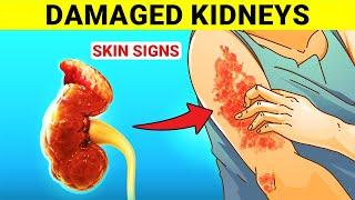 9 Skin Signs That May Indicate Your Kidneys Are Damaged