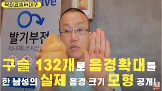 감당불가 음경확대, 구슬 132개로 음경확대를 한 남성의 역대급 실제 음경 크기 모형 최초 공개!/ 놀라운 음경 크기에 비뇨기과 의사마저 저절로 고개를 숙임 [음경확대 닥터코넬]