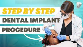 Dental Implant Steps - What to Expect During Your Implant Procedure