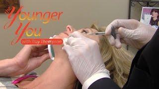 The Younger You- Episode 20 Injectables