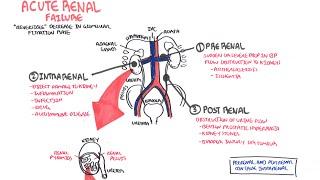 Acute Renal Failure