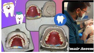 Flasking #dental #dentistry #viral #umairtoothfairy #teeth @Umairazeem8553