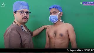 Revision Gynecomastia Surgery || Male breast Reduction || Dr. Jayanta Bain plastic surgeon