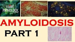 AMYLOIDOSIS: Part 1: Definition, Historical aspects & Properties of Amyloid