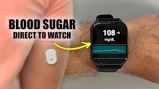 I Tried a New CGM Watch That Actually Works!