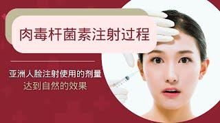 How to Get Rid of Wrinkles Effectively | 肉毒杆菌注射过程 | Anna Hoo Clinic