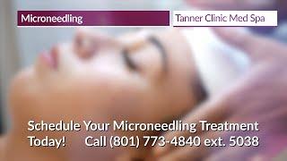 Microneedling at the Tanner Clinic Med Spa in Syracuse, Utah