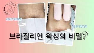 Waxing 브라질리언왁싱 다리왁싱 겨드랑이왁싱 슈가링왁싱 (feat.친한언니슈가링왁싱)