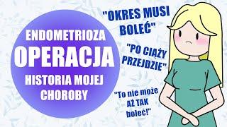 Potrzebuję operacji – endometrioza, historia mojej choroby