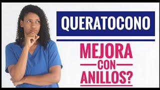 Queratocono | Experiencia con anillos intracorneales