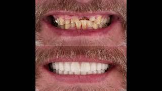 One procedure. One smile. One brand new chapter.