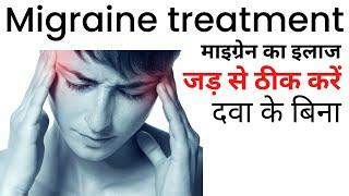 Migraine ka ilaj | Migraine treatment at home in Hindi