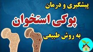 اینطوری پوکی استخوان نمی گیری | پیشگیری و درمان پوکی استخوان با روشهای طبیعی . #پوکی_استخوان