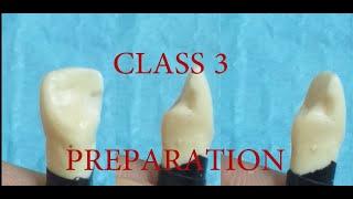 CLASS 3 III PREP for COMPOSITE - TEETH SECTION - DR SAEED REDA