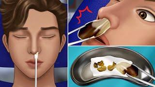 ASMR Giant Snot Removal Animation‼️, Cleaning Waste in the Nostril, Rhinitis Treatment