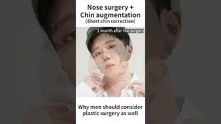 Male nose surgery & Chin augmentation in Korea