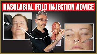 Nasolabial fold injection advice. | Botox vs Filler