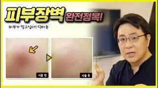 피부장벽의 모든것/피부장벽의 정의/피부장벽관리/피부장벽치료