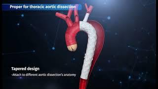 Castor Branched Aortic Stent Graft System