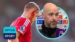 'Why should he have to go off?' | Erik ten Hag upset with 'setback' around De Ligt head injury