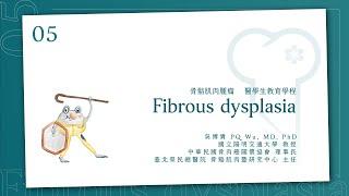 纖維發育不全 Fibrous dysplasia │骨骼肌肉腫瘤 醫學生教育課程_5│ 吳博貴醫師