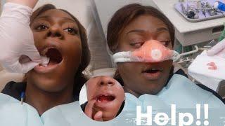 I Got My Wisdom Teeth Removed ! Oral Surgery Vlog + Recovery Video