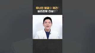 실리프팅에 대한 진실?ㅣ 피부과전문의가 솔직하게 밝힙니다!