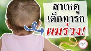 พัฒนาการทารก : สาเหตุเด็กทารกจึงผมร่วง!!! | ทารกผมร่วง | เด็กทารก Everything