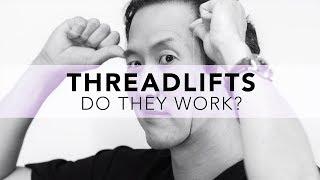 What is the REAL truth about Threadlifts? No spin here!