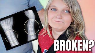 Parker BROKE Her ARM!