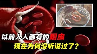 以前几乎人人都有的蛔虫，现在为何消失了？这种“糖”功不可没