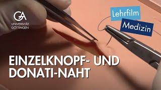 Einzelknopf- und Donati-Naht