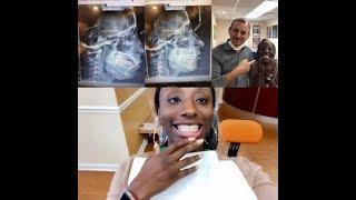 Getting my adult braces REMOVED!! Entire procedure from start to finish ||SusieB