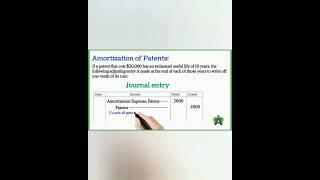 Patent amortization: #shortvideo #youtubeshorts #ytshorts