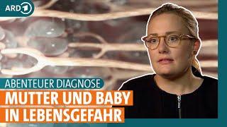 Abenteuer Diagnose: Was steckt hinter Kopfschmerzen und Fieber in der Schwangerschaft? | ARD GESUND