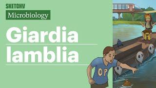 Giardia lamblia Lesson: Transmission & Treatment (Full Lesson) | Sketchy Medical | USMLE Step 1