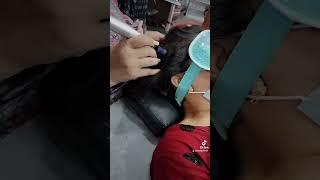 Needling