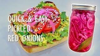 Easy Flavor Enhancer | Pickled Red Onions | Starts With Kitchen