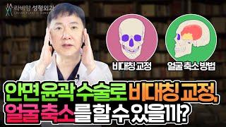 [안면윤곽수술 Q&A 2편] 비대칭 교정부터 관자놀이 축소, 고정나사 문제까지! 자주 묻는 질문 2탄  안면윤곽, 뭐든지 물어보세요!