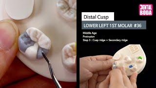 Lower Left 1st Molar  distal cusp 3 ridge (middle-aged) Wax-Up #36-4B