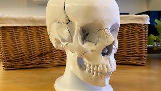 Assembly of 3D Printed Human Skull Model