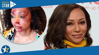 Mel B is awarded MBE in New Year Honours list for services to domestic violence victims 360943